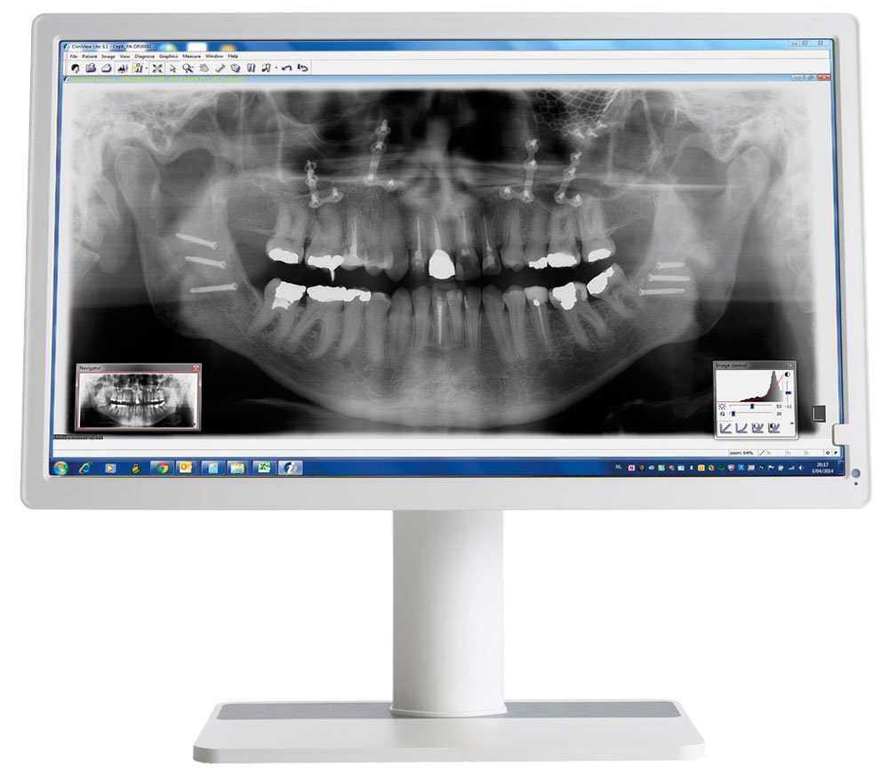 Barco MDNC-2123 DEWH